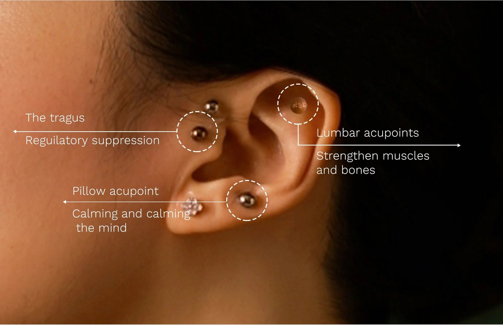 auricular therapy