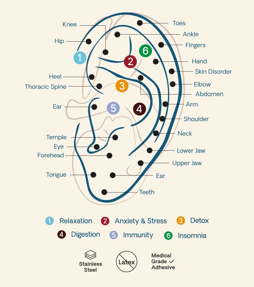 An illustrated ear seed chart showing the key acupressure points for sleep and insomnia relief.