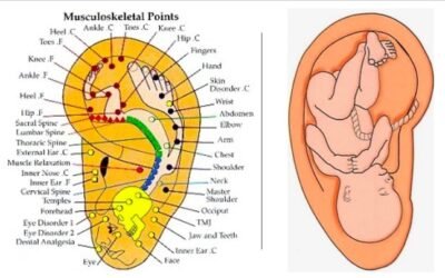 An illustration of the inverted fetus theory, showing how the entire body is mapped on the ear hologram.