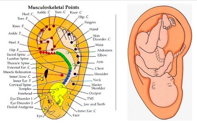 An illustration of the inverted fetus theory, showing how the entire body is mapped on the ear hologram.
